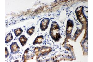 Anti- Hsp60 Picoband antibody, IHC(P) IHC(P): Mouse Intestine Tissue (HSPD1 抗体  (AA 260-496))