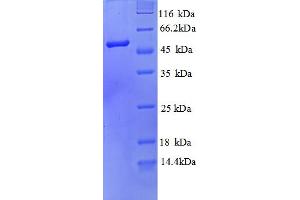 Sep (O-phosphoserine) tRNA:Sec (Selenocysteine) tRNA Synthase (SEPSECS) (AA 5-451), (partial) protein (His tag)