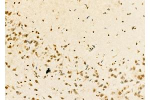 ABIN6263713 and ABIN6273274 at 1/100 staining Rat brain tissue by IHC-P.