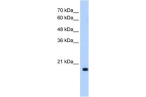 Western Blotting (WB) image for anti-DCTP Pyrophosphatase 1 (DCTPP1) antibody (ABIN2462971) (DCTPP1 抗体)