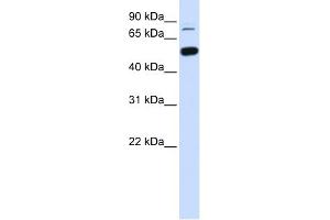 WB Suggested Anti-SMARCD1 Antibody Titration: 0. (SMARCD1 抗体  (Middle Region))