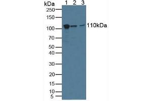 Western blot analysis of (1) Human A549 Cells, (2) Human HeLa cells and (3) Human Lung Tissue.
