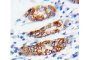 Used in DAB staining on fromalin fixed paraffin-embedded Stomach tissue (Connexin 31 抗体  (AA 211-269))