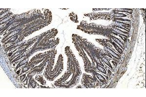 IHC analysis of YTHDF2 using anti-YTHDF2 antibody (ABIN7603191). (YTHDF2 抗体  (N-Term))