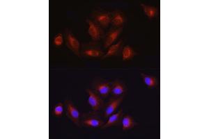 Immunofluorescence analysis of U2OS cells using  Rabbit pAb (ABIN3020671, ABIN3020672, ABIN1512605 and ABIN6213659) at dilution of 1:100 (40x lens). (ATF6 抗体  (AA 1-190))