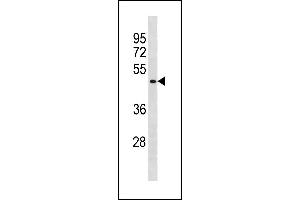 BCL6B Antibody (Center) (ABIN1881109 and ABIN2843280) western blot analysis in A549 cell line lysates (35 μg/lane). (BCL6B 抗体  (AA 276-302))