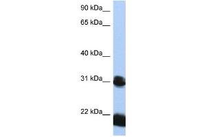 WB Suggested Anti-OTX1 Antibody Titration:  0. (OTX1 抗体  (N-Term))