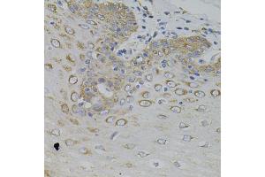 Immunohistochemistry of paraffin-embedded human esophagus using IRF1 antibody (ABIN5995375) (40x lens).