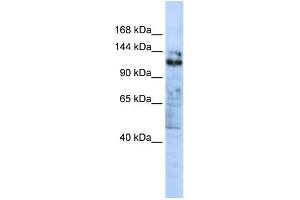 WB Suggested Anti-ZNF451 Antibody Titration:  0. (ZNF451 抗体  (C-Term))