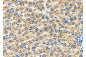ABIN6259559 and ABIN6273934 at 1/100 staining Rat liver tissue by IHC-P.