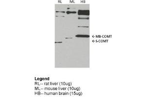 COMT antibody - middle region  validated by WB using rat liver, mouse lung, human brain at 1:1000. (COMT 抗体  (Middle Region))