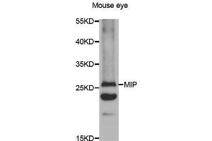 Western blot analysis of extracts of mouse eyes tissue lysate, using MIP antibody. (MIP 抗体)