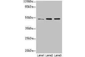 Western blot All lanes: GPR83 antibody at 2 μg/mL Lane 1: HCT116 whole cell lysate Lane 2: U87 whole cell lysate Lane 3: MCF-7 whole cell lysate Secondary Goat polyclonal to rabbit IgG at 1/10000 dilution Predicted band size: 49 kDa Observed band size: 49 kDa (GPR83 抗体  (AA 349-423))