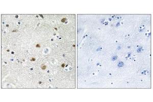 Immunohistochemistry analysis of paraffin-embedded human brain tissue using TF3B antibody. (BRF1 抗体  (Internal Region))