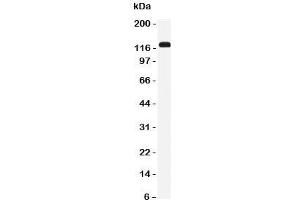 Western blot testing of NKCC2 antibody and rat kidney tissue lysate. (SLC12A1 抗体  (N-Term))