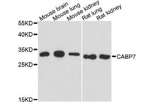 Western blot analysis of extracts of various cell lines, using CABP7 antibody. (CABP7 抗体)
