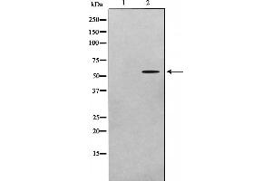 Western blot analysis on A549 cell lysate using ADCK1 Antibody,The lane on the left is treated with the antigen-specific peptide. (ADCK1 抗体  (Internal Region))