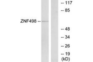 Western blot analysis of extracts from COS7 cells, using ZNF498 Antibody. (Zinc Finger and SCAN Domain Containing 25 (ZSCAN25) (AA 331-380) 抗体)