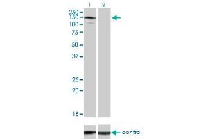 Western blot analysis of ABL2 over-expressed 293 cell line, cotransfected with ABL2 Validated Chimera RNAi (Lane 2) or non-transfected control (Lane 1). (ABL2 抗体  (AA 743-842))