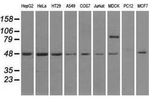 Western blot analysis of extracts (35 µg) from 9 different cell lines by using anti-LEMD3 monoclonal antibody. (LEMD3 抗体)