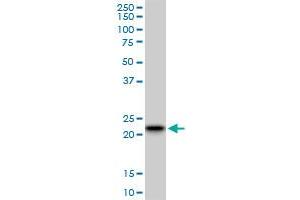 Western Blotting (WB) image for anti-RAB7B, Member RAS Oncogene Family (RAB7B) (AA 100-199) antibody (ABIN567027)
