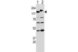 Western blot analysis of CLASP (arrow) using rabbit polyclonal CLASP Antibody (pTyr1019) . (CLASP2 抗体  (AA 1005-1034))