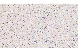 Detection of LDHA in Human Cardiac Muscle Tissue using Polyclonal Antibody to Lactate Dehydrogenase A (LDHA) (Lactate Dehydrogenase A 抗体  (AA 1-332))