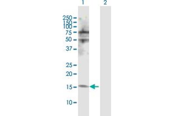 NUDT2 Antikörper  (AA 1-147)