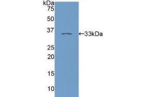 Western blot analysis of recombinant Human PKCe. (PKC epsilon 抗体  (AA 403-672))