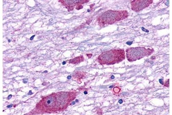 GPR162 抗体  (Extracellular Domain)