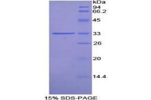 SDS-PAGE analysis of Rat Pim-2 Oncogene Protein.