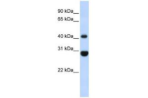 CNP antibody used at 1 ug/ml to detect target protein. (Cnpase 抗体  (Middle Region))