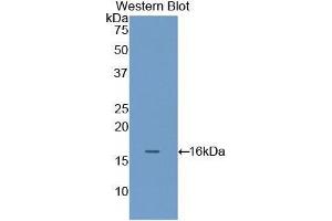 Western Blotting (WB) image for anti-Filamin B, beta (FLNB) (AA 2061-2193) antibody (ABIN1858902)