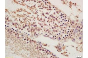 Formalin-fixed and paraffin embedded rat testies labeled with Rabbit Anti-ORP1 Polyclonal Antibody, Unconjugated (ABIN2178099) at 1:200 followed by conjugation to the secondary antibody and DAB staining (OSBPL1A 抗体  (AA 851-950))