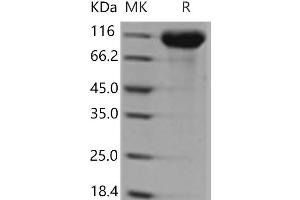 Western Blotting (WB) image for Angiotensin I Converting Enzyme 2 (ACE2) (Active) protein (His tag) (ABIN7321233)