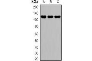 Western blot analysis of DDX58 expression in Jurkat (A), HepG2 (B), MCF7 (C) whole cell lysates. (DDX58 抗体)