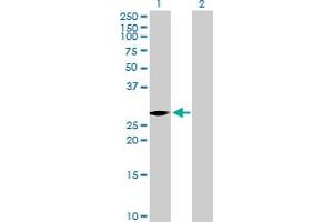Western Blot analysis of VENTX expression in transfected 293T cell line by VENTX MaxPab polyclonal antibody. (VENTX 抗体  (AA 1-258))