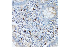 Immunohistochemistry (IHC) image for anti-Ribonuclease, RNase A Family, K6 (RNASE6) (AA 1-150) antibody (ABIN7269987)