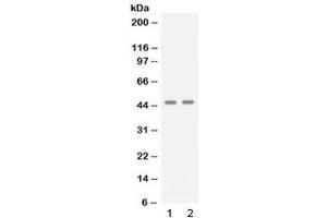 Western blot testing of 1) human A431 and 2) human Jurkat cell lysate with APOBEC3G antibody at 0. (APOBEC3G 抗体)