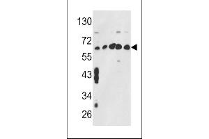 Western blot analysis of CCT3 Antibody (Center) (ABIN389422 and ABIN2839505) in MCF7,CEM,K562,HL-60,Hela cell line lysates (35 μg/lane). (CCT3 抗体  (AA 298-326))