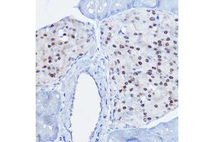 Immunohistochemistry of paraffin-embedded mouse pancreas using NKX6-1 antibody (ABIN7268929) at dilution of 1:50 (40x lens). (NKX6-1 抗体)