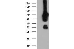 Western Blotting (WB) image for anti-N-Myristoyltransferase 2 (NMT2) antibody (ABIN1499781) (NMT2 抗体)