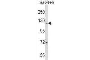 Western Blotting (WB) image for anti-Collagen, Type XIX, alpha 1 (COL19A1) antibody (ABIN3000558) (COL19A1 抗体)