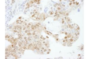 anti-Karyopherin alpha 3 (Importin alpha 4) (KPNA3) (AA 1-50) antibody