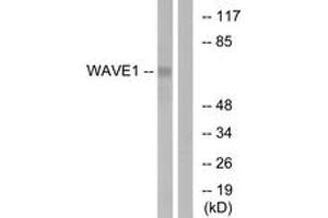 Western blot analysis of extracts from 293 cells, treated with insulin 0. (WASF1 抗体  (AA 91-140))