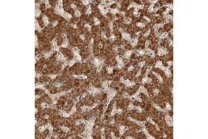 Immunohistochemical staining of human liver with C1orf26 polyclonal antibody  shows distinct cytoplasmic positivity in hepatocytes at 1:200-1:500 dilution. (SWT1 抗体)