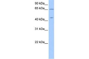 Human 721_B; WB Suggested Anti-ZPLD1 Antibody Titration: 0. (ZPLD1 抗体  (C-Term, Isoform 2))