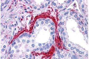 Human Prostate: Formalin-Fixed, Paraffin-Embedded (FFPE) (ATG5 抗体  (C-Term))