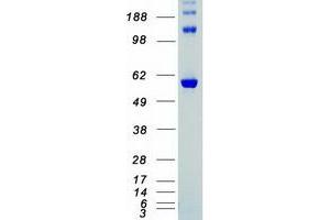 Western Blotting (WB) image for Checkpoint Kinase 2 (CHEK2) (Transcript Variant 1) (Active) protein (Myc-DYKDDDDK Tag) (ABIN2713979)