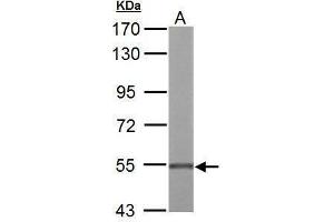 WB Image UGDH antibody detects UGDH protein by Western blot analysis. (UGDH 抗体)